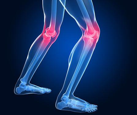 illustration of Knee Pain