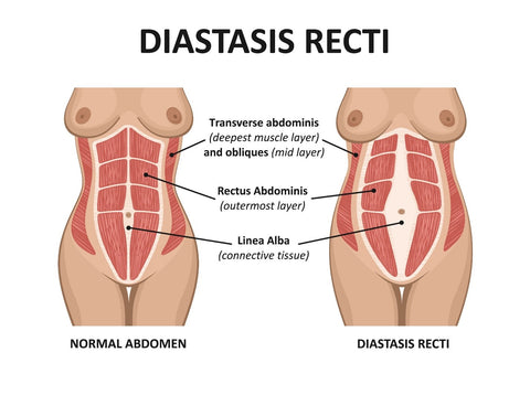 Belly Diagram