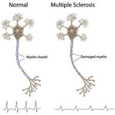 Nerve Regeneration