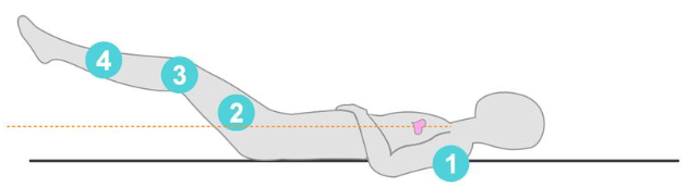 illustration correct foot elevation posture