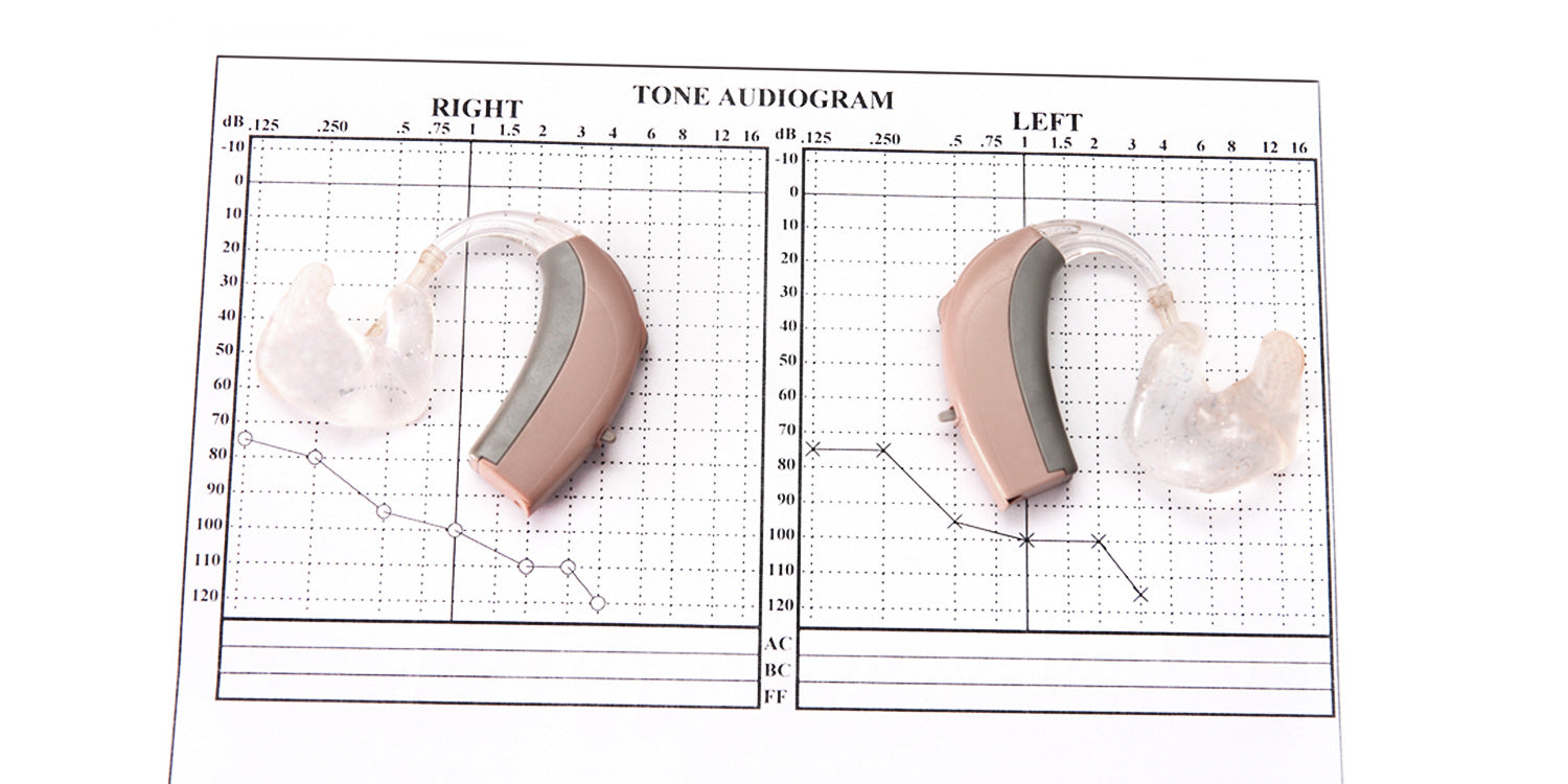 hearing aid audiogram