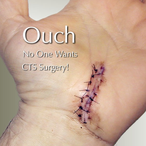 Did Your Dr. Tell You to have Carpal Tunnel Surgery?