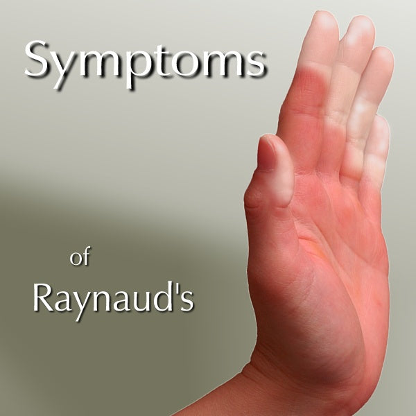 Symptoms of Raynaud's Syndrome