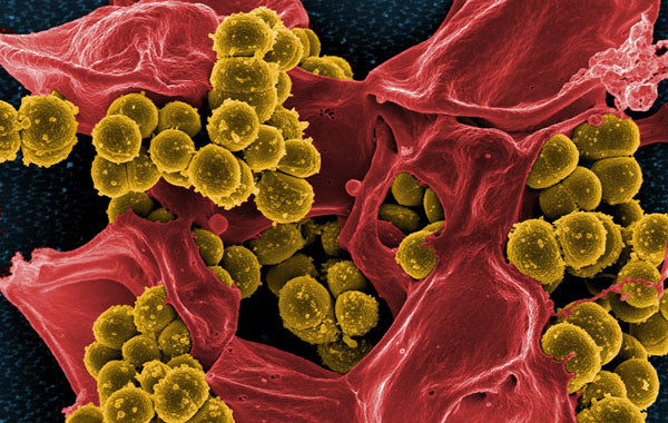Staphylococcus Bacteria