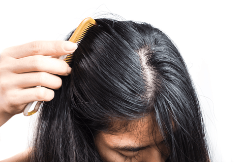 Cheveux gras solution