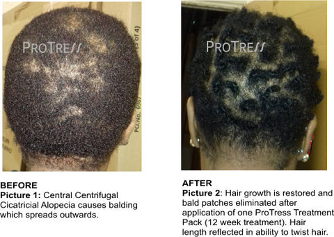 dry hair causes hair loss