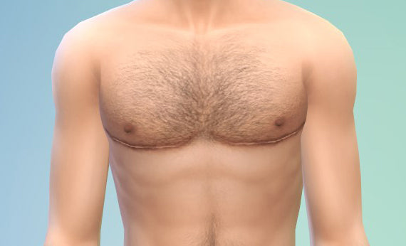 FTM Chest Surgery Tips
