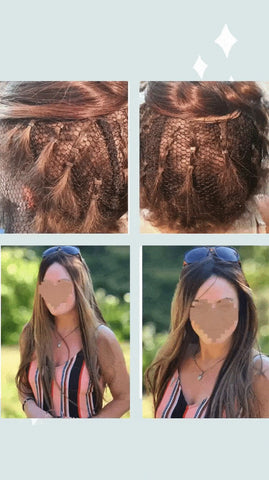 Before and after hair integration 
