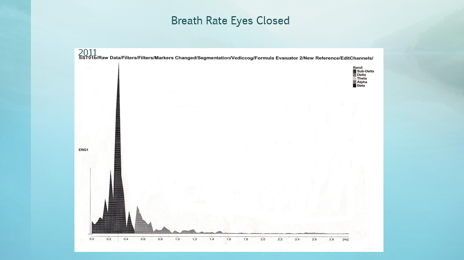 Breath Rate Eyes Closed 2011