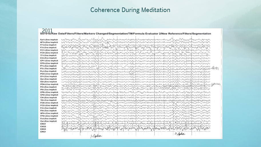 Coherence During Meditation