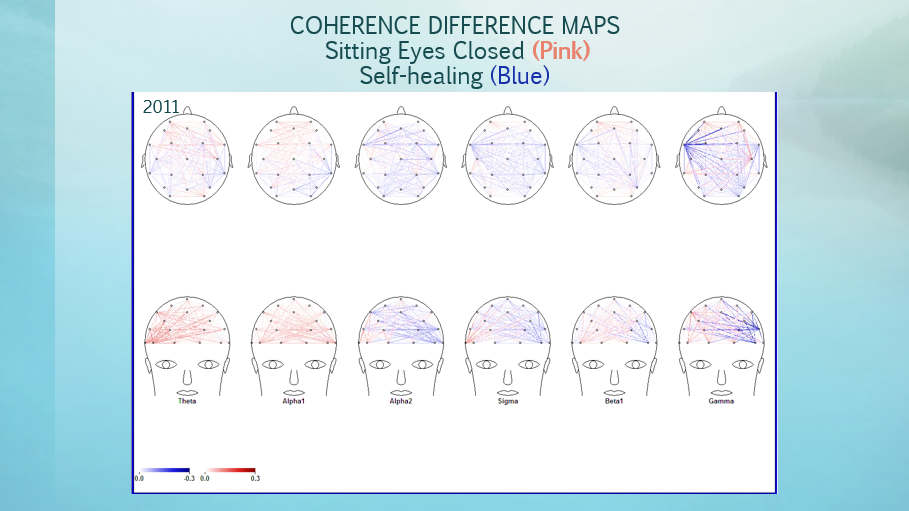 CDM Eyes Closed Self Healing 2011