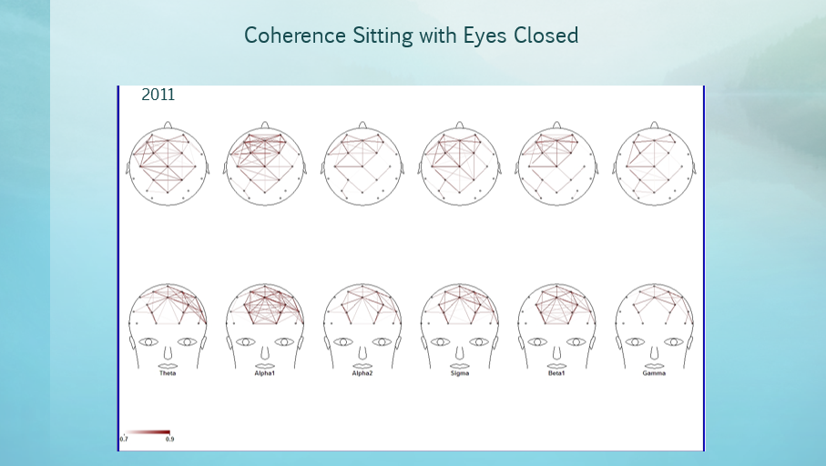 Coherence Eyes Closed 2011