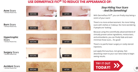 Dermafface FX7 Product Testing Results- Dare-U-Go! Blog- Scar Treatment