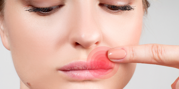 Woman pointing to early cold sore symptoms on upper lip.