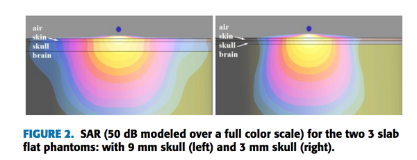 cellphone radiation and kids