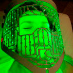 mascara luz led verde para combatir manchas faciales