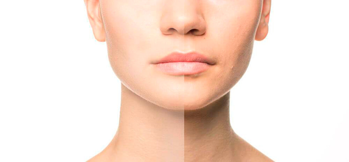 Rejuvenece tu rostro con medicina estetica