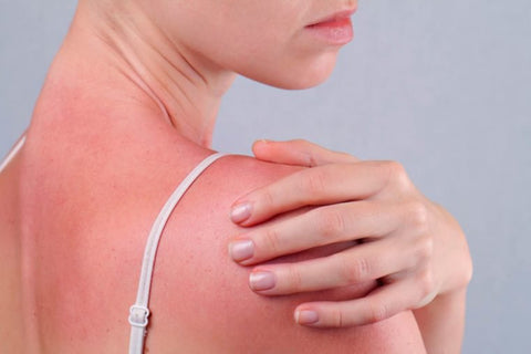 Sunstroke & Nausea Natural Remedy (BM254)