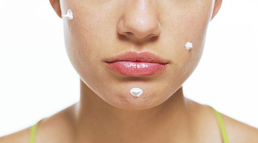 toxins in traditional acne toners