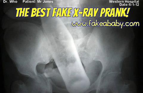 Fake X-ray