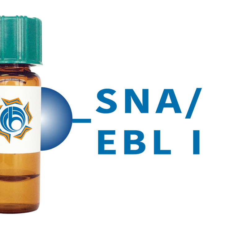 sambucus nigra (elderberry) lectin (sna/ebl i) - separopore03