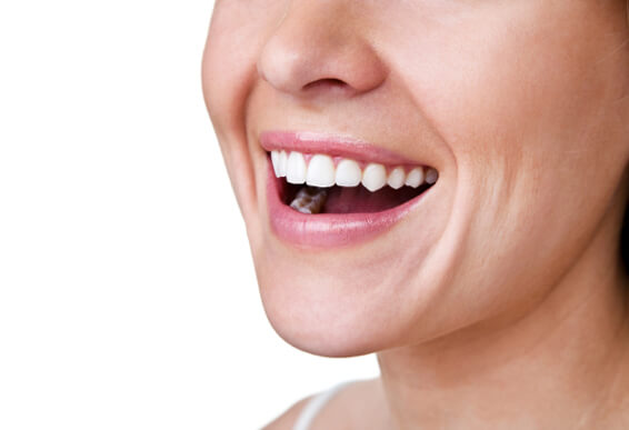 white-teeth