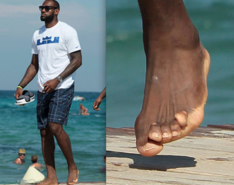 LeBron James’ feet. Not looking good after years of wearing high dollar footwear on the courts.