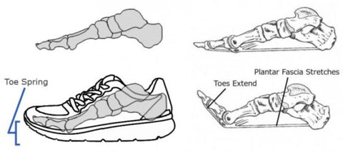 Here is a great illustration of how the last two bones of the foot (metatarsals) are forced into extension (curved upward) in a shoe with toe spring.