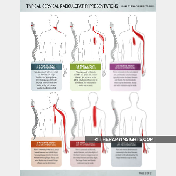 Typical Cervical Radiculopathy Presentations Therapy Insights 7871