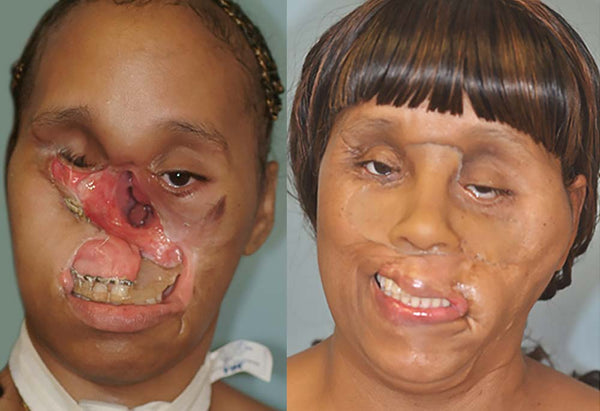 Carolyn Thomas Before and After