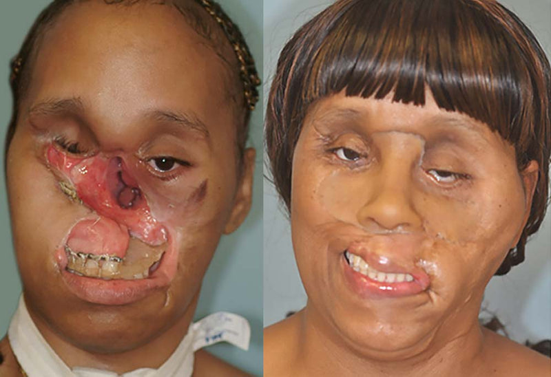Carolyn Thomas Before and After