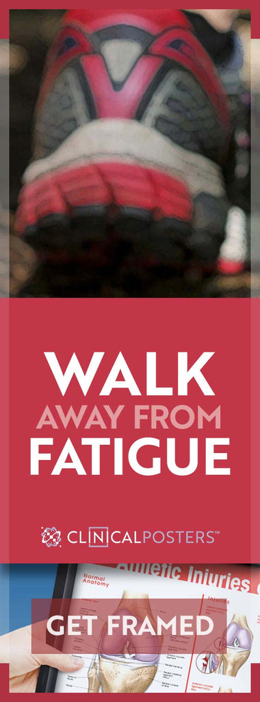 Can You Walk Away From Fatigue?