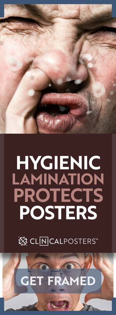 Simplest Explanation Why You Need Laminated Posters
