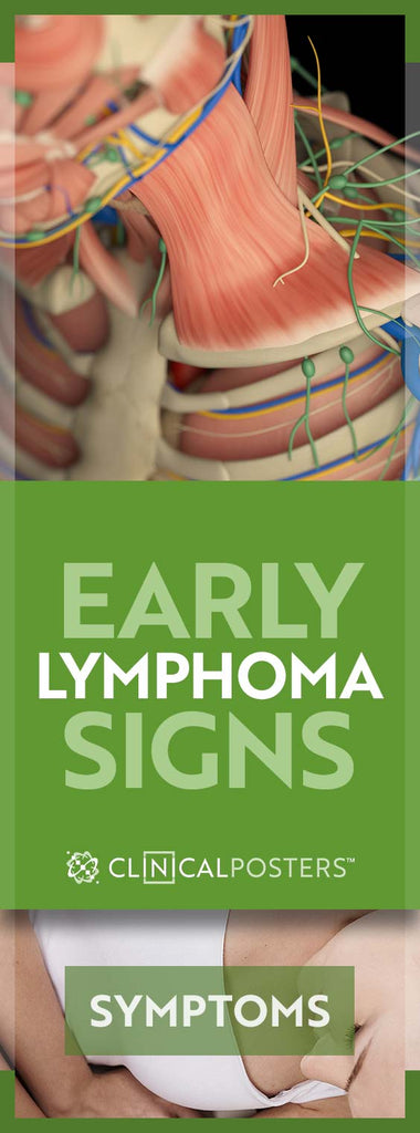 Early Warning Signs and Symptoms of Lymphoma