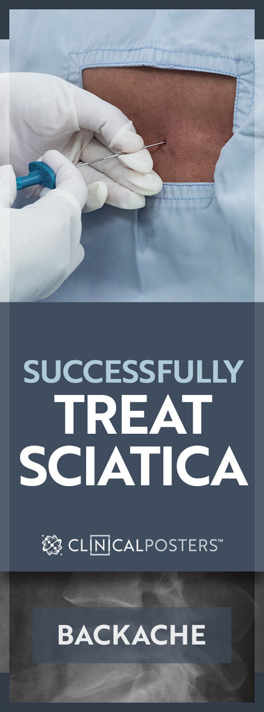 Successfully Treating Sciatic Pain