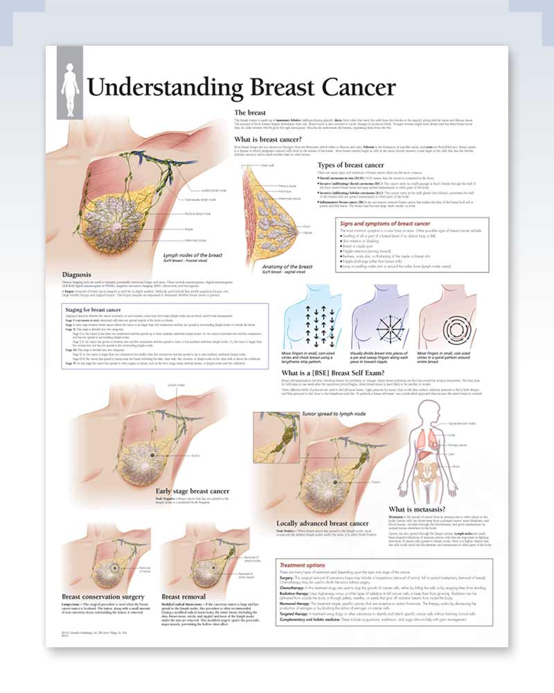 understanding breast cancer anatomy poster