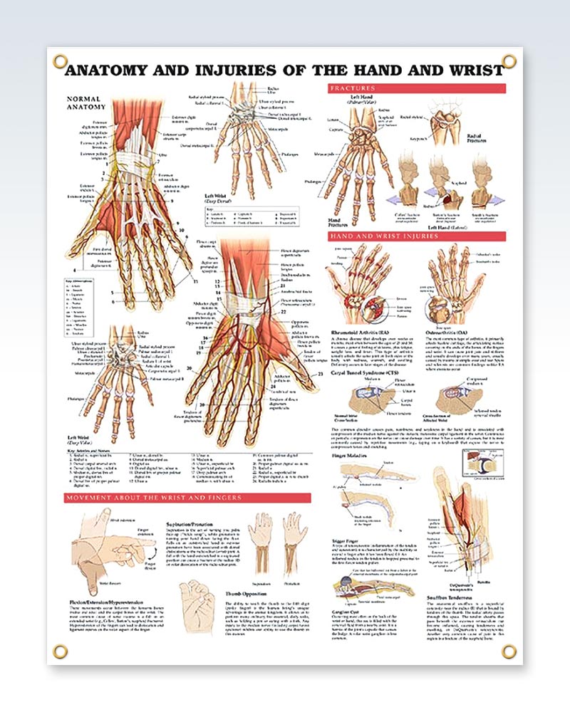 Injuries Hand and Wrist Laminated Chart 20x26