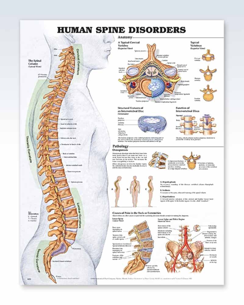 Human Spine Disorders Exam Room Anatomy Poster Clinicalposters