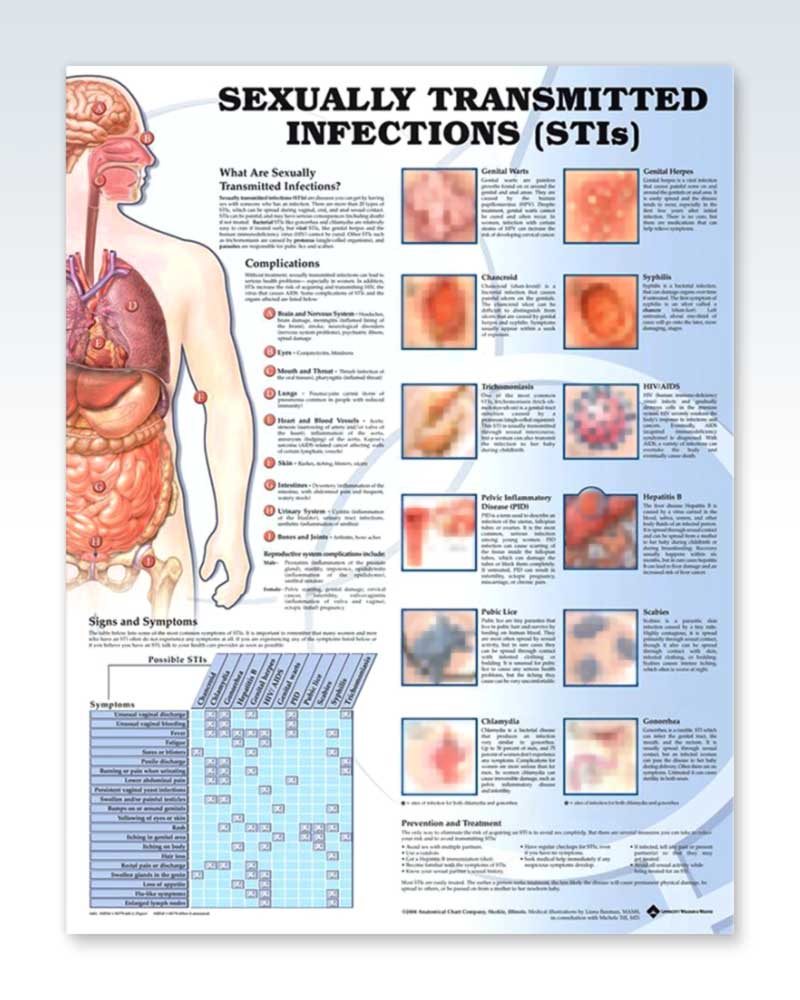 Sexually Transmitted Infections Exam Room Anatomy Poster Clinicalposters 6160