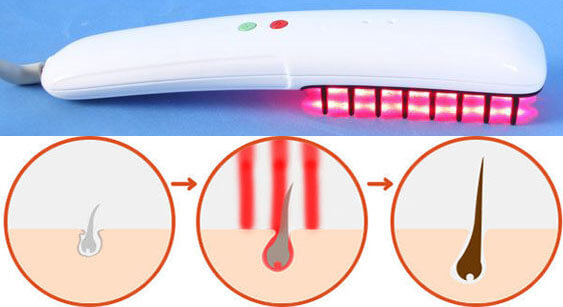 laser comb stimulates hair growth