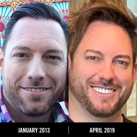 Buck Wimberly - Before and after skin care regimen