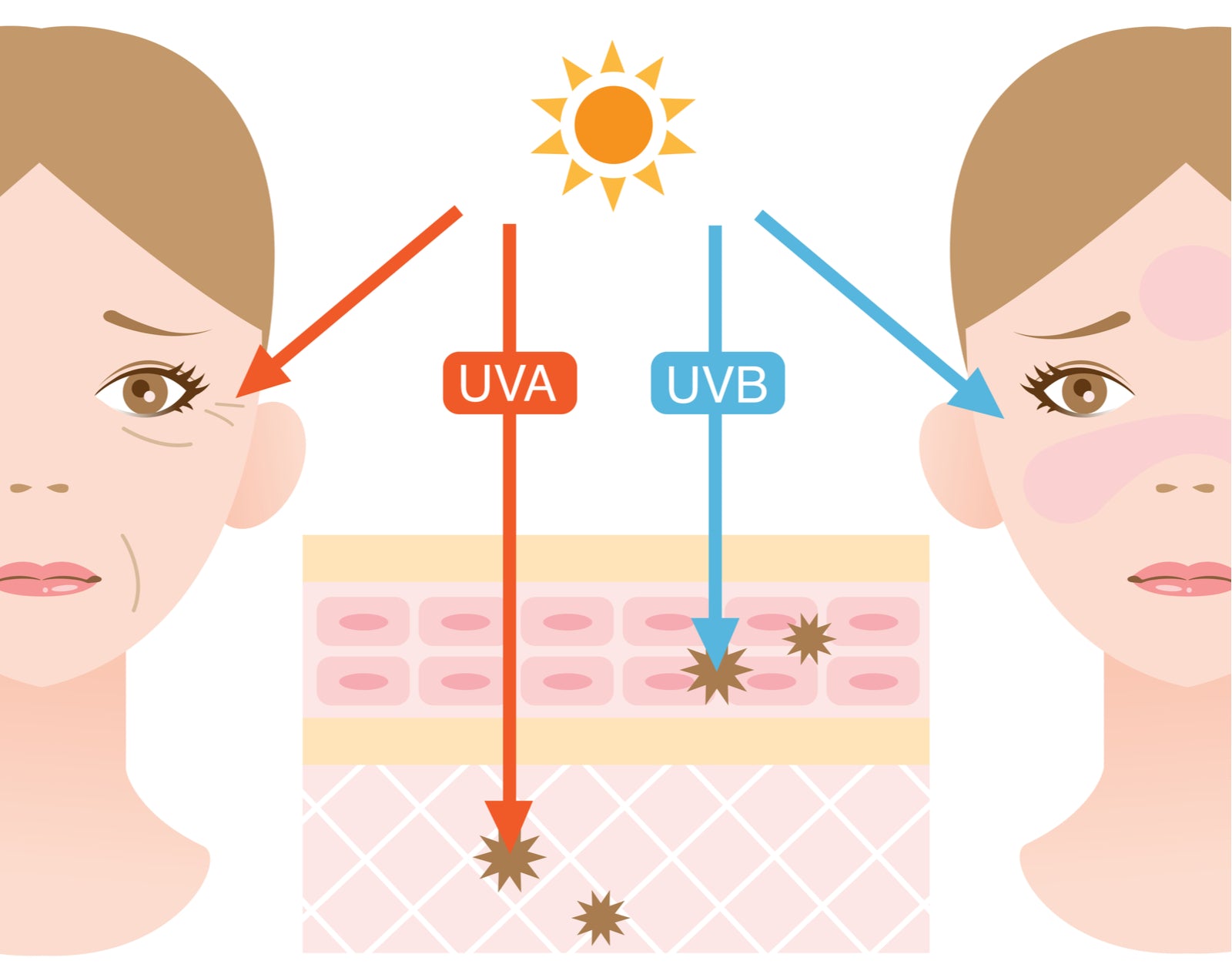 infographic skin illustration. the difference between UVA and UVB rays penetration