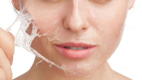 Complete Guide To At-Home Chemical Peels