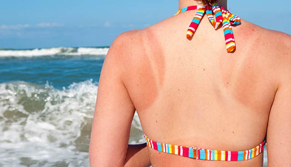 5 Sunscreen Myths