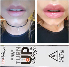 Lip Voltage