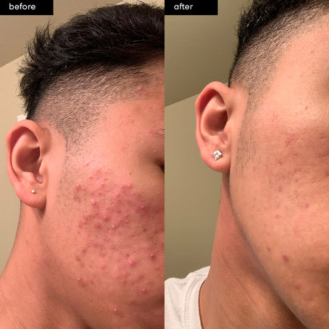 SLMD Success Story Testimonial