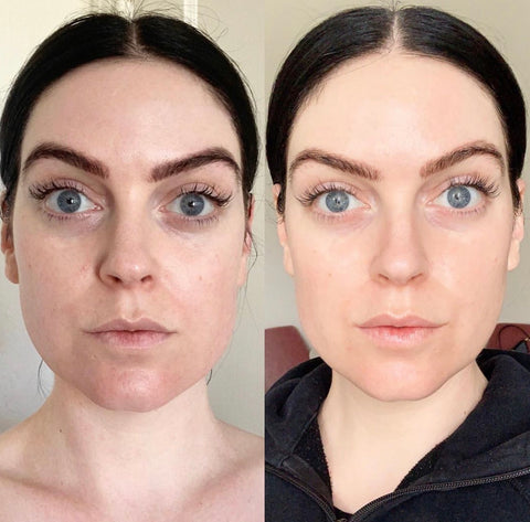 the organic esthetician instagram before and after