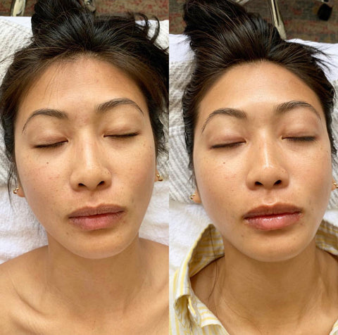 organic esthetician before and after microcurrent for estheticians facial lifting treatment