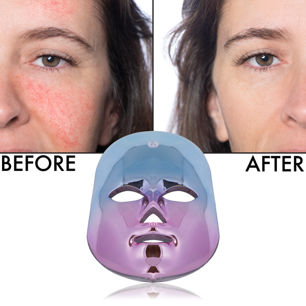 Flawless Face LED Mask | Multi-Purpose Care LED Mask | Cordless N – Secret Collagen