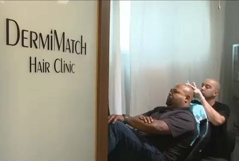 scalp micropigmentation arizona